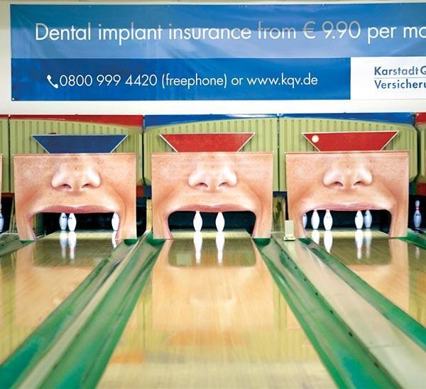 dental implant insurance 1