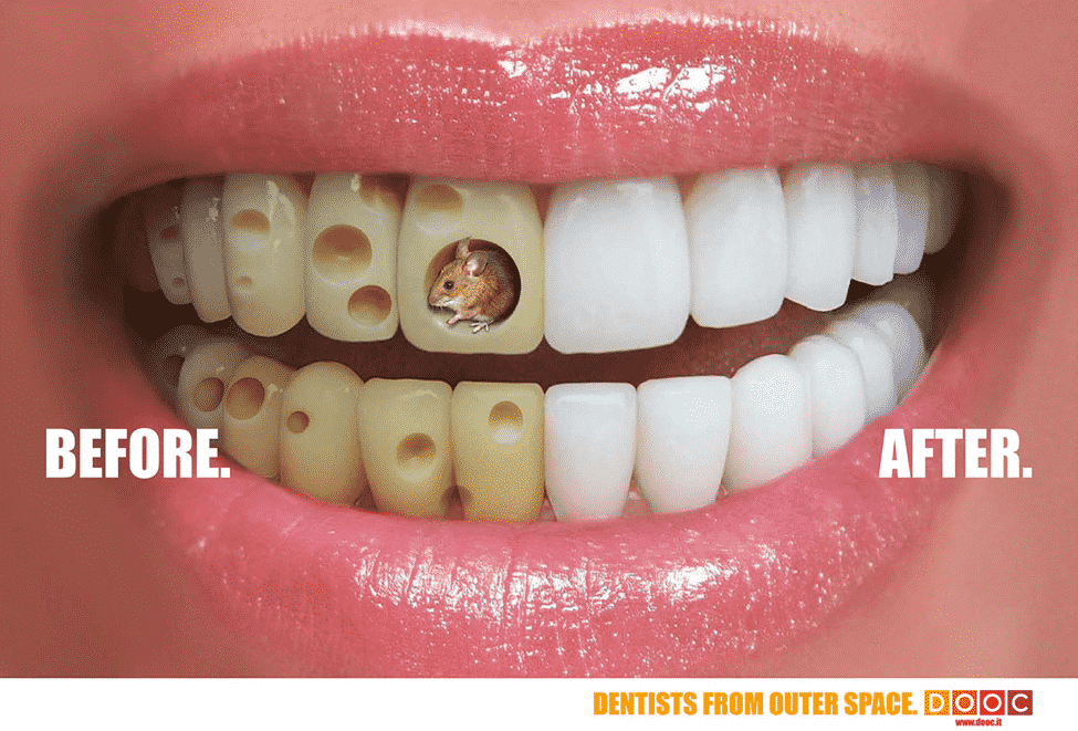holes in teeth